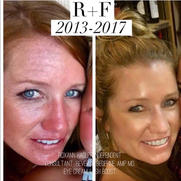 Meet your Posher: A Rodan & Fields Consultant! - Picture 8 of 8